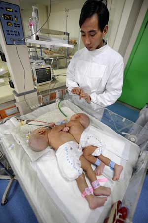 Father of the conjoined twin girls stands beside the bed before separation surgery at Hunan Children's Hospital in Changsha, capital of central China's Hunan Province, April 1, 2009.