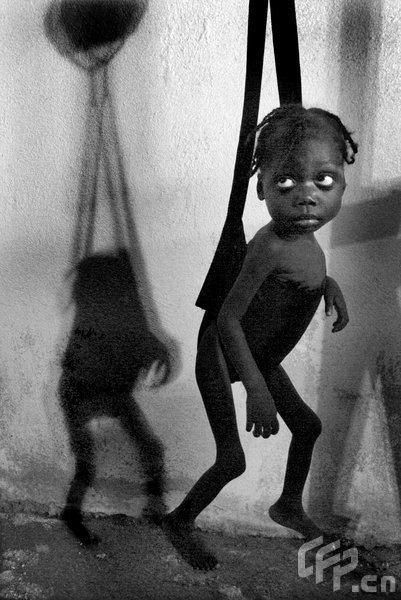Four-year-old Venecia Lonis, now 16 pounds after two weeks of care, shown Nov. 21, 2008, was so malnourished when she first reached a clinic in Martissant, Haiti, that her mother was planning her funeral. [CFP] 