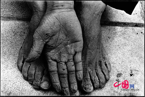 Hand and feet of a skycraper cleaner Zhong Jiacai, 1997