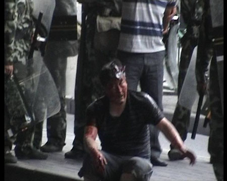 Photo released by police shows an innocent civilian injured in riots in Urumqi, capital of northwest China's Xinjiang Uygur Autonomous Region on July 5, 2009. [chinadaily.com.cn]