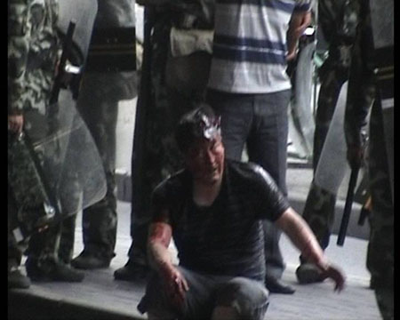 Photo released by police shows an innocent civilian injured in riots in Urumqi, capital of northwest China&apos;s Xinjiang Uygur Autonomous Region on July 5, 2009. [chinadaily.com.cn]