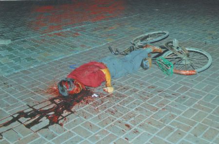 File photo released by the government of Urumqi City in a press conference in Urumqi, capital of northwest China's Xinjiang Uygur Autonomous Region, on July 7, 2009, shows a victim of the riot.[Xinhua]