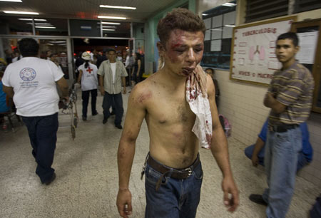 A man injured during the soccer fan clash arrives at a hospital to get treatment in Tegucigalpa, capital of Honduras, July 26, 2009. Two people were killed and more than 15 others injured on Sunday in a soccer fan clash outside a stadium in the Honduran capital, police said. It is yet unclear whether the violence had links with the country's political stalemate. [David De La Paz/Xinhua] 