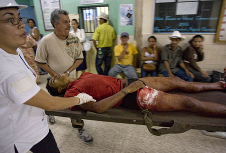 A man injured during the soccer fan clash is sent to a hospital in Tegucigalpa, capital of Honduras, July 26, 2009. [David De La Paz/Xinhua]