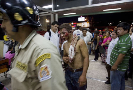 A man injured during the soccer fan clash arrives at a hospital to get treatment in Tegucigalpa, capital of Honduras, July 26, 2009. [David De La Paz/Xinhua]