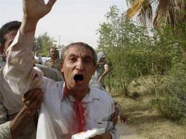 An injured man shouts after clashes with Iraqi forces in Camp Ashraf, north of Baghdad July 29, 2009. [CCTV/REUTERS/National Council of Resistance of Iran/Handout]