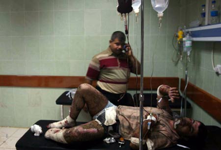 A wounded man is treated in a hospital in the northern Iraqi city of Kirkuk, where an explosion occured, killing 5 people and injured 36 on Thursday, Aug. 6, 2009. At least 5 people were killed and 36 injured on Thursday during an explosion in the northern Iraqi city of Kirkuk, police source said. [Xinhua/AFP]