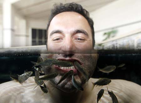 Garra rufa obtusas, also known as "doctor fish", swim around the face of a man as he relaxes in a hot spa pool in Kangal, 105 kilometers (65 miles) south of the central Anatolian city of Sivas August 9, 2009. The treatment is believed to heal Psoriasis, a chronic skin disease which affects the joints and skins. Garra rufa obtusa, also known as "doctor fish" which live in mineral-rich hot spa pools, is used in the treatment as they nibble away the diseased skin. The mineral-rich water is then believed to aid in the healing process of the lesions. People suffering from psoriasis travel to Kangal to stay at the spa for 21 days and visit the fish pools twice daily for four-hour treatment sessions. Picture taken August 9, 2009. 