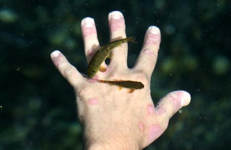 Garra rufa obtusas, also known as "doctor fish", swim near the hand of a psoriasis patient in a hot spa pool in Kangal, 105 kilometers (65 miles) south of th