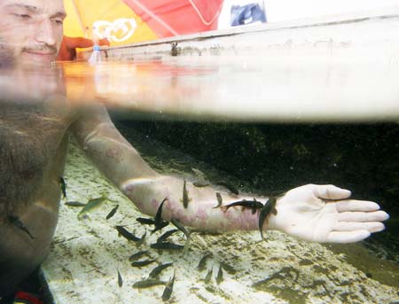 Garra rufa obtusas, also known as "doctor fish", nibble on the skin of a psoriasis patient in a hot spa pool in Kangal, 105 kilometers (65 miles) south of the central Anatolian city of Sivas August 9, 2009.