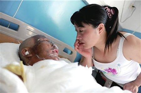 A seriously-burnt worker touches his girlfriend at a Beijing hospital, August 13, 2009. [Xinhua] 