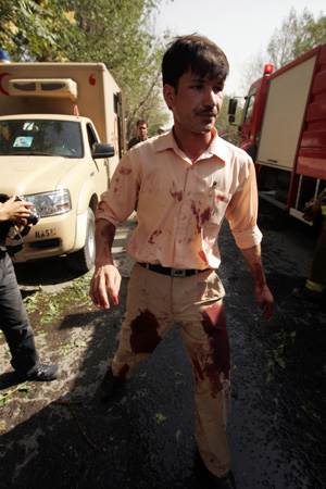 An Afghan stained with blood leaves the site of the suicide bomb attack in Kabul, capital of Afghanistan, August 15, 2009.