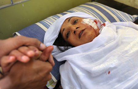 An injured Pakistani woman in hospital after a suicide car bomb blast attack on a police station in Kohat on October 15. Militants unleashed coordinated attacks on Pakistani police in which 39 people died Thursday, storming offices in Lahore and bombing a northwest station to escalate 11 days of carnage.[AFP/Xinhua]