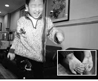 Boy with cut-off hands recovering