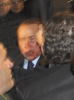 Italy&apos;s Prime Minister Silvio Berlusconi leaves Duomo&apos;s square with blood on his face after a political party meeting in Milan December 13, 2009. [Xinhua/Reuters] 