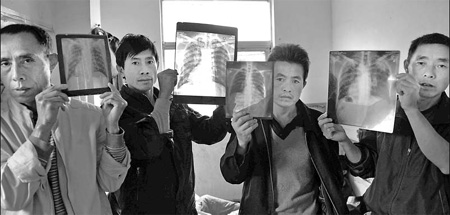 Pneumatic drill operators suffering from lung afflictions show their chest X-rays in a Shenzhen hospital this month.[Southern Metropolis Daily]