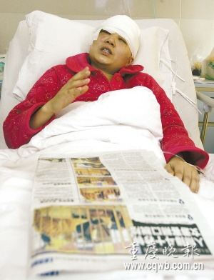  Long Wei displays the wounds she suffered after a lion attack when photographing tigers on the performing stage at an animal circus on Sunday, January 10, 2010 in southwest China's Chongqing municipality. [Photo: cqwb.com.cn]