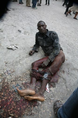 Picture taken on Jan. 12, 2010 shows injured people in Haiti&apos;s capital Port-au-Prince. [Xinhua/Radioteleginenhaiti.com]