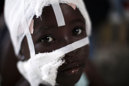 Seven-year-old Stepanie lies injures in a makeshift hospital on a street in Port-au-Prince January 15, 2010. [Xinhua]