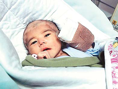 The latest photo of baby girl Xi Wang, who was abandoned by her parents because she suffered life-threatening birth defects.