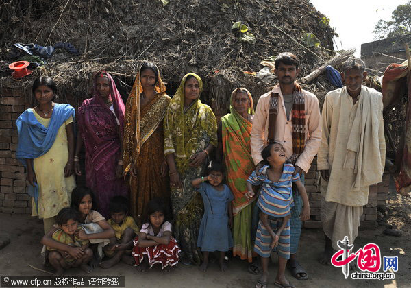 Deepak Kumar Paswaan with his family. This 7-year-old boy living in Buxar, Bihar, eastern India, has a pair of feet growing out of his chest. [CFP]