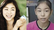 Did Kim Yuna have plastic surgery?