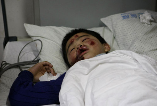 A person injured in the drink driving accident involving city legislator Yang Shuzhong lies on a hospital bed in in Sanmen County, Taizhou City, east China's Zhejiang Province on Tuesday morning, April 6, 2010. [Photo: CFP]