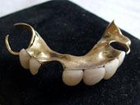 Winston Churchill's dentures sold at auction for 23,000 US dollars