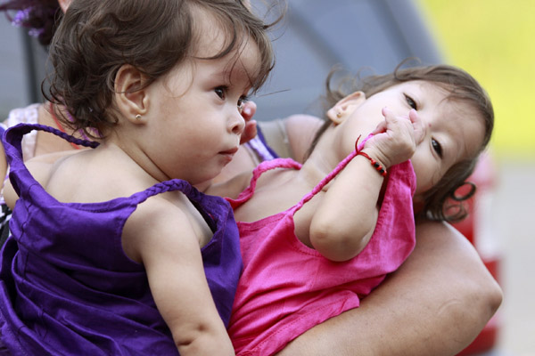 Siamese twins Hannah Yinneth (R) and Hannah Yanneth attend their first birthday party in Panama City August 14, 2010.[Xinhua/Reuters ]