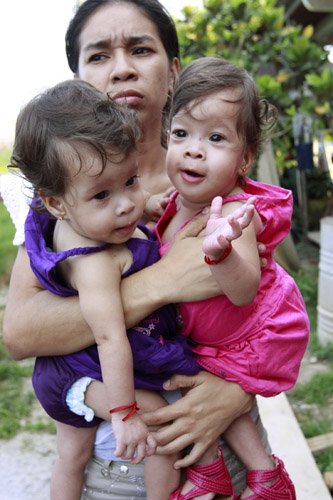 Siamese twins Hannah Yinneth (R) and Hannah Yanneth are carried by their mother Sara Gil as they attend their first birthday party in Panama City August 14, 2010.[Xinhua/Reuters ]