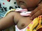 No evidence milk powder caused infant breasts