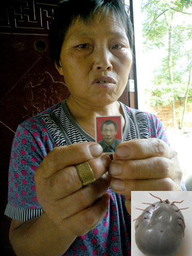 The wife (Top) of Bao Xiangyi, a villager from Henan province who died nine days after being bitten in May by a tick (Down, Right), holds his photo in grief on Aug 24. [Sun Xuyang / for China Daily] 