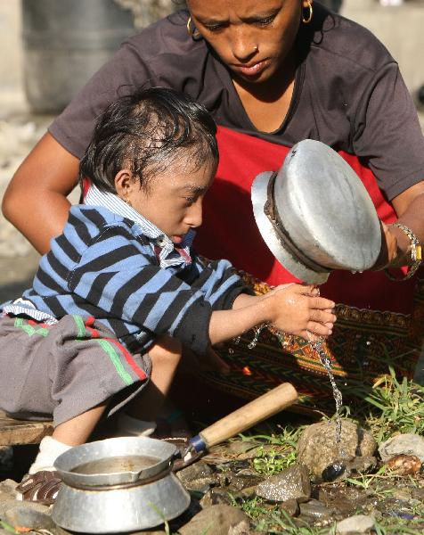 Khagendra Thapa washes his hands in Pokhara West Nepal October 13, 2010. Thapa, who is turning 18 on October 14, will be declared by the Guinness World Records to the shortest man in the world. [Xinhua/AFP] 