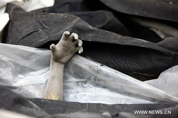 Photo taken on Nov. 5, 2010 shows a hand of a victim in Volcano Merapi's latest re-eruption at Dr. Sardjito Hospital in Yogyagarta, Central Java of Indonesia. ([hang Yuwei/Xinhua]