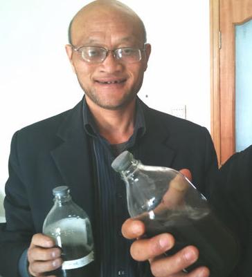 51-year-old coal miner Long Huaiwen underwent a lung lavage in Xinjiang Occupational Disease Hospital on October 18, which generated 48 bottles of black water.