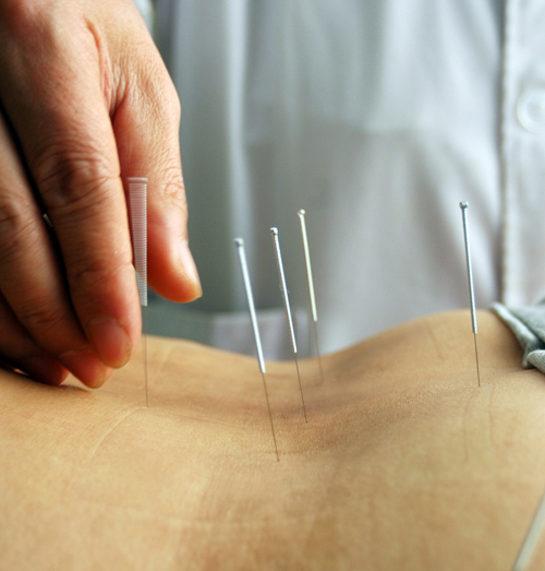 Internationally, traditional Chinese medicine, acupuncture in particular, has been officially recognized and is widely practiced in countries like Japan, the United States, Germany and Republic of Korea (ROK), experts said