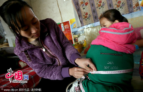 Girl At Has Swollen Belly Due To Unknown Disease China Org Cn