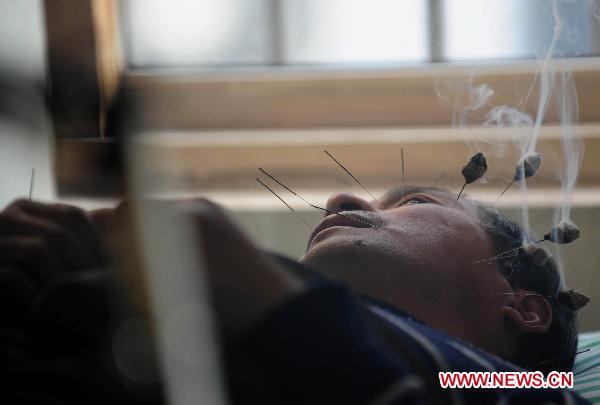 A citizen receives treatment of moxibustion at a Chinese medicine hospital in Jiaxing City, east China&apos;s Zhejiang Province, Nov. 17, 2010.