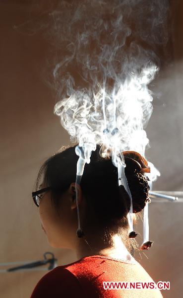 A citizen receives treatment of moxibustion at a Chinese medicine hospital in Jiaxing City, east China&apos;s Zhejiang Province, Nov. 17, 2010.