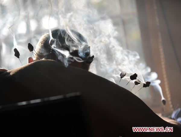 A citizen receives treatment of moxibustion at a Chinese medicine hospital in Jiaxing City, east China&apos;s Zhejiang Province, Nov. 17, 2010.