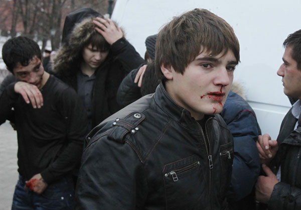 Youths from Russia&apos;s north Caucasus region bleed after being attacked by football fans and right wing protesters during a rally in central Moscow Dec 11, 2010. [China Daily/Agencies]