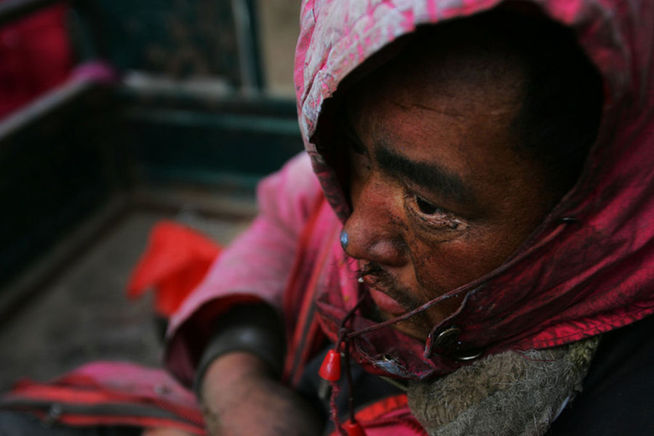 Mentally disabled Liu Xiaoping is seen on December 19, 2010 in Gaoling county, Shaanxi Province of China. Liu was rescued by policemen from a illegal factory in Toksun county of Northwestern China&apos;s Xinjiang Uygur Autonomous Region. [Agencies]