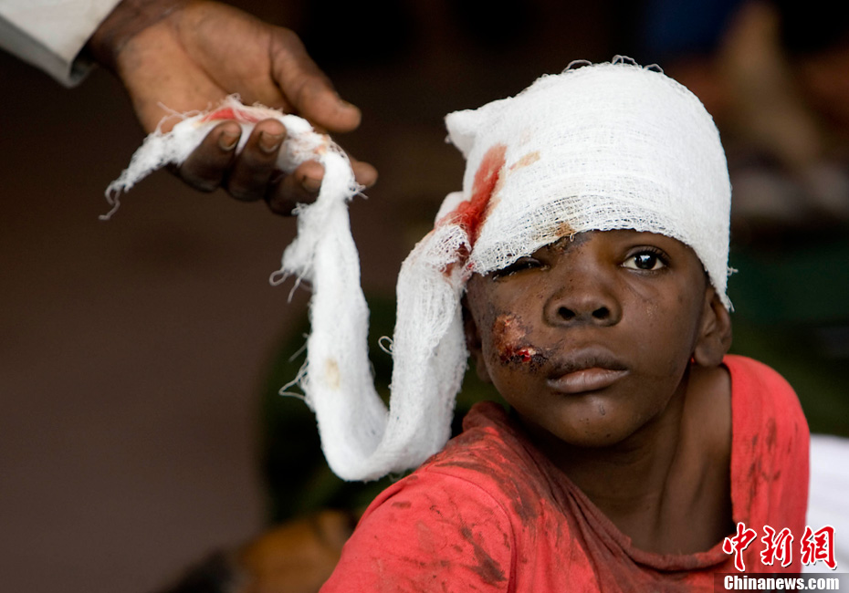 A boy received treatment after Haiti earthquake on January 14, 2010. [Chinanews.com] 