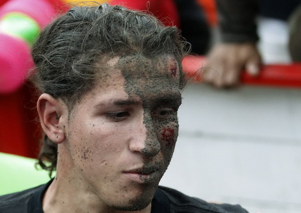 A man leaves with injuries after being hit by a bull in an improvised bullring during the annual bullfight festival in Zapote, near San Jose, Dec 28, 2010. [China Daily/Agencies]