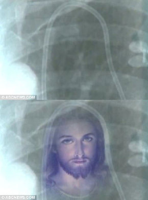 ABC News superimposed an image of Christ over Ms Sigler's x-ray.