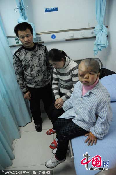 Wen Yonglan waits for an operation at the First Affiliated Hospital of Harbin Medical University on January 16, 2011 in Harbin, Heilongjiang Province of China. Wen Yonglan is a 16-year-old girl of Ewenke ethnic minority who had congenital skull defect and hydrocephalus. [Photo/CFP] 