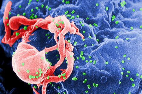 An electron scan showsthe HIV-1 virus budding (in green) from a white blood cell in a laboratory.