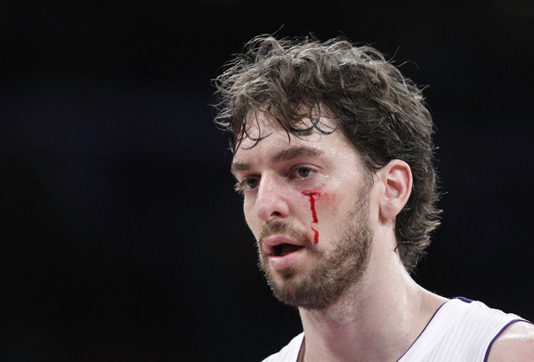 Los Angeles Lakers Pau Gasol of Spain bleeds from a cut on his face during the first half of Game 1 of their NBA Western Conference first round playoff basketball game against the New Orleans Hornets in Los Angeles, California April 17, 2011. (Xinhua/Reuters Photo)