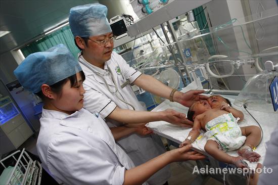 Conjoined twins that resemble a baby girl with two heads born on May 5 receive treatment at a hospital in Suining, Sichuan province, on Monday. The twins, 51cm long and weighing 4.05 kg, are still in a dangerous condition. The case is the first of its kind in China. [Asianewsphoto]