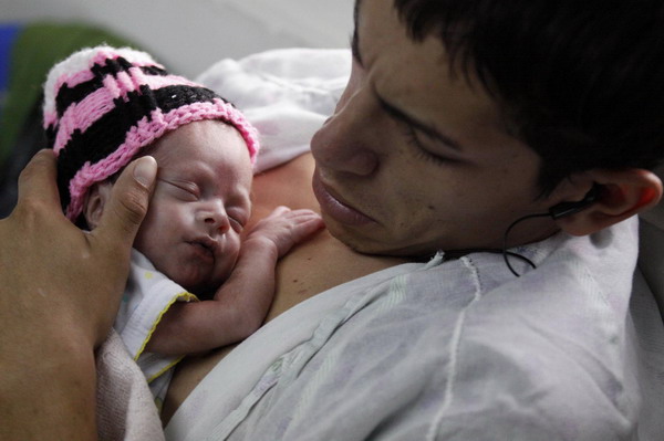 'Kangaroo Care' benefits newborns